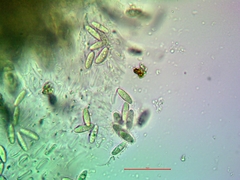 Placopyrenium stanfordii