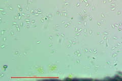 Placopyrenium stanfordii