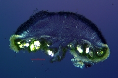 Lecanora meridionalis