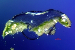 Lecanora gangaleoides