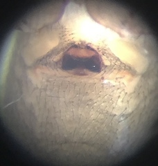 Robertus fuscus