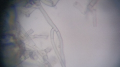 Byssocorticium atrovirens