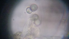 Byssocorticium atrovirens