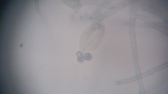 Byssocorticium atrovirens
