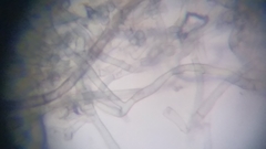 Byssocorticium atrovirens