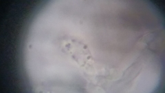 Byssocorticium atrovirens