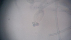 Byssocorticium atrovirens