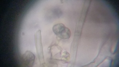 Byssocorticium atrovirens