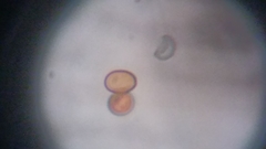 Byssocorticium atrovirens