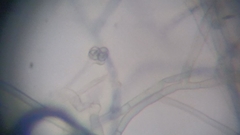 Byssocorticium atrovirens