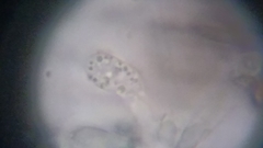 Byssocorticium atrovirens
