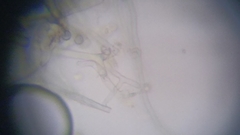 Byssocorticium atrovirens