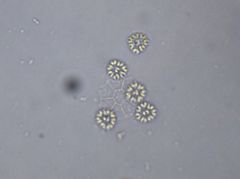 Hydrodictyaceae