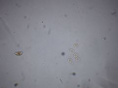 Hydrodictyaceae