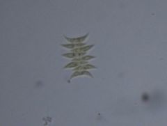 Tetradesmus dimorphus