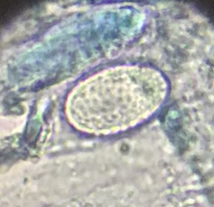 Scutellinia olivascens