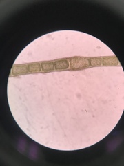 Rhizoclonium tortuosum