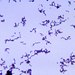 Propionibacterium acnes - Photo CDC/Bobby Strong, δεν υπάρχουν γνωστοί περιορισμοί πνευματικών δικαιωμάτων (Κοινό Κτήμα)