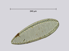 Surirella