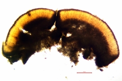 Trapeliopsis glaucopholis