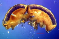 Trapeliopsis glaucopholis