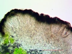 Strangospora moriformis