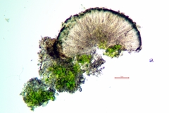 Strangospora moriformis
