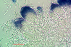 Strangospora moriformis
