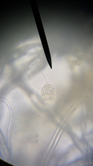 Vorticella