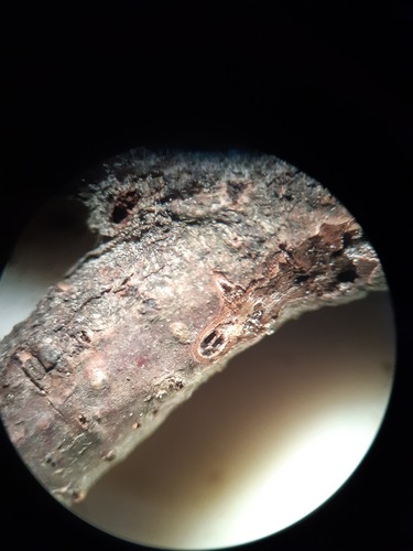 Allantoporthe decedens