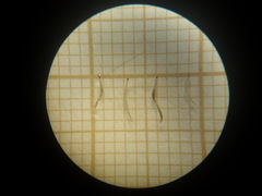 Culicoides