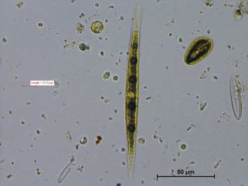 Closterium idiosporum