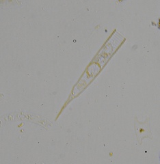 Helicostomella