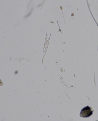 Helicostomella