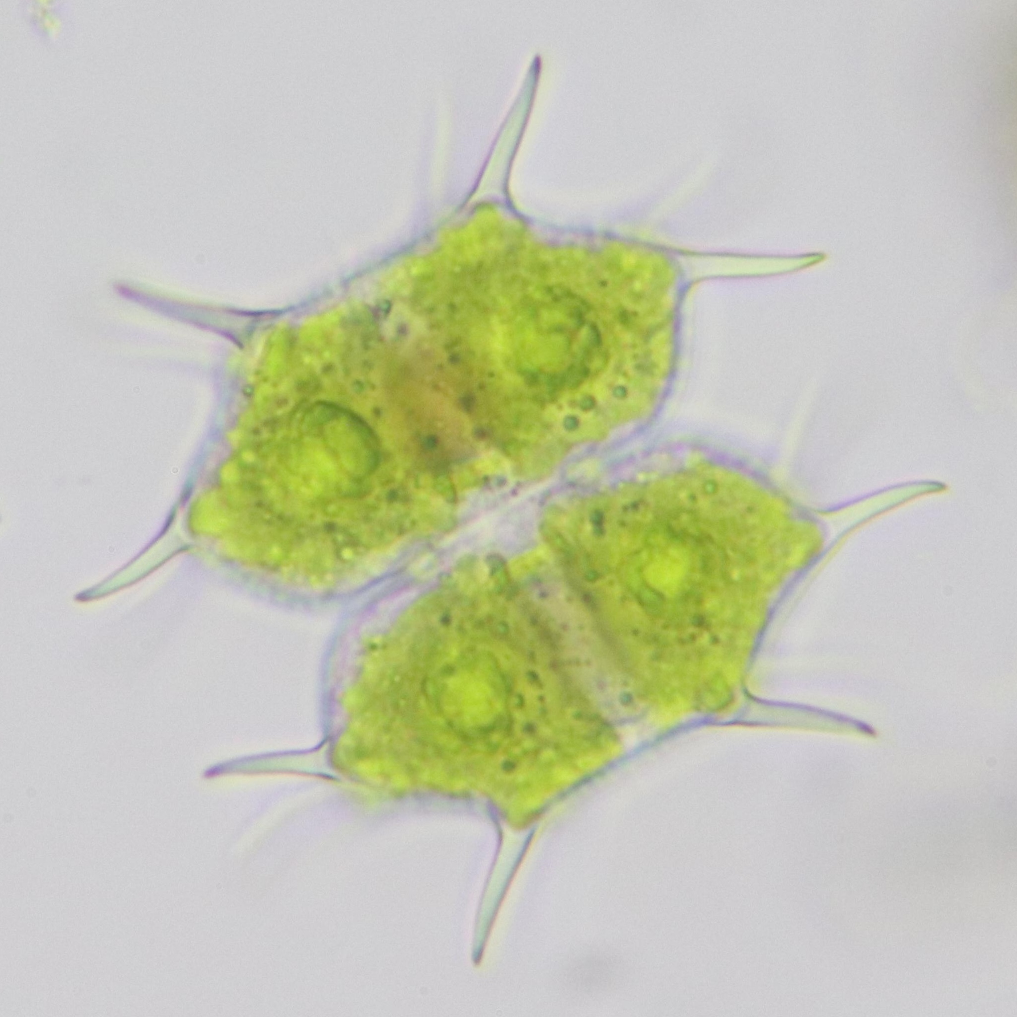Xanthidium antilopaeum var. planum