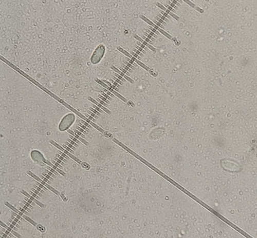 Boeremia hedericola