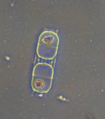 Stephanopyxis palmeriana