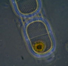 Stephanopyxis palmeriana