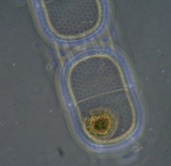 Stephanopyxis palmeriana