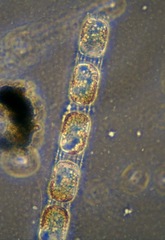 Stephanopyxis palmeriana