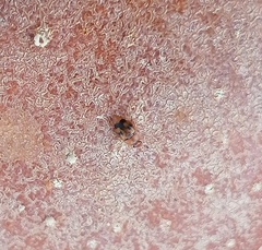 Epuraea ocularis