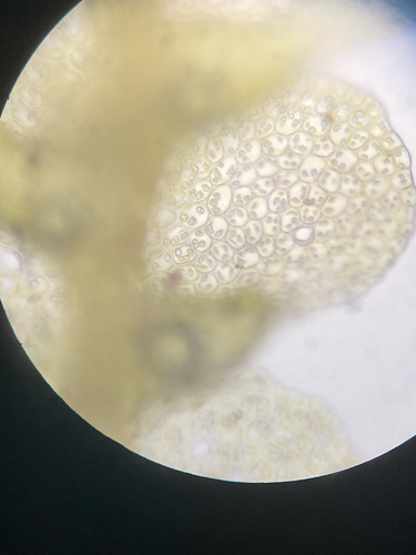 Lejeunea cladogyna