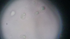 Fuscoporia ferruginosa