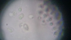 Fuscoporia ferruginosa