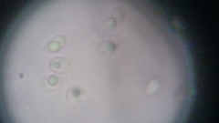 Fuscoporia ferruginosa