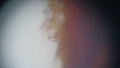 Fuscoporia ferruginosa
