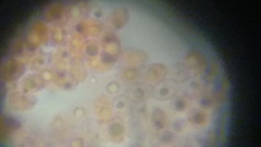 Fuscoporia ferruginosa