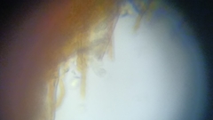 Fuscoporia ferruginosa