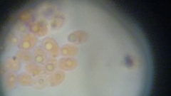 Fuscoporia ferruginosa