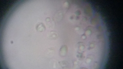 Fuscoporia ferruginosa